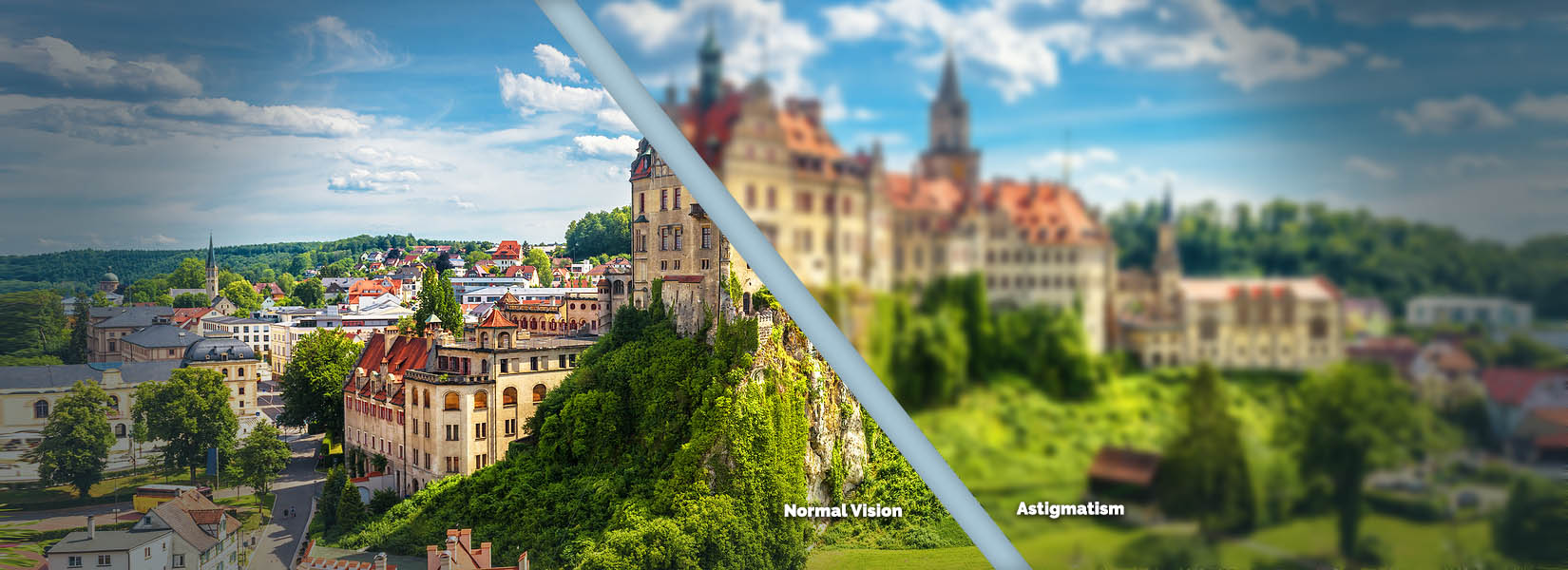 Astigmatism Treatment in Northwest Side