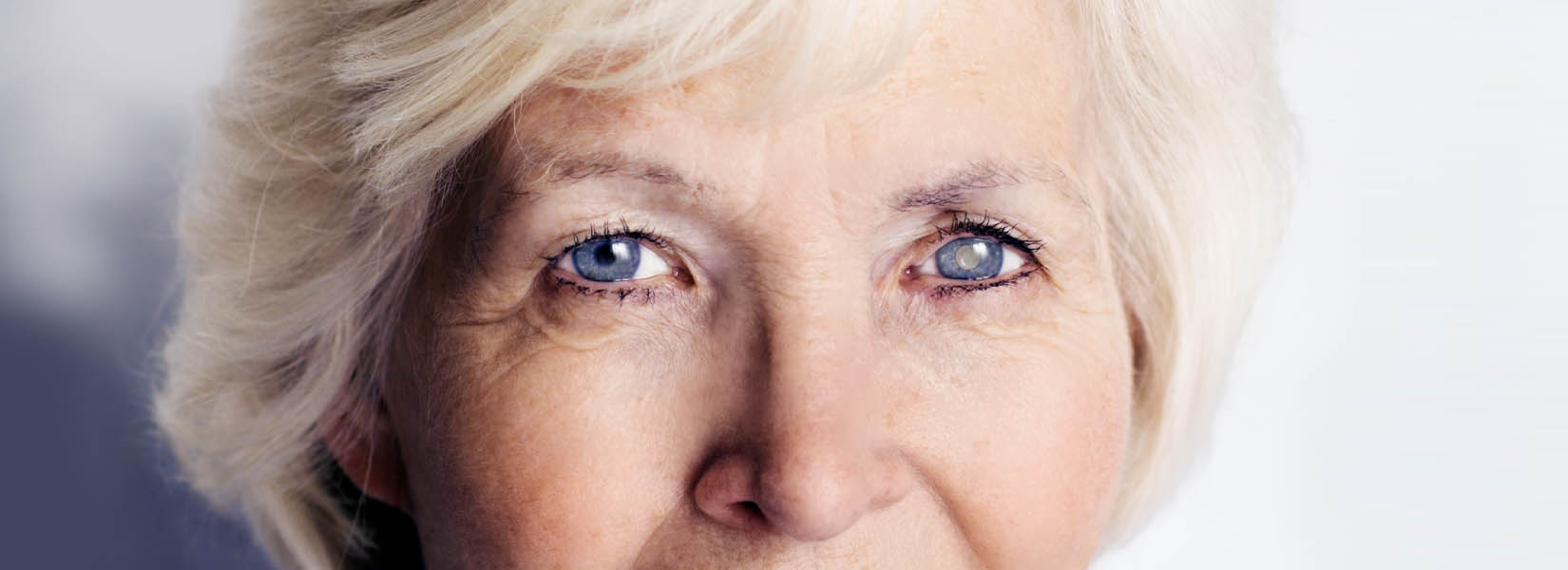 Cataract Surgery in Northwest Side